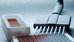 治疗|抗核抗体阳性、抗ro52抗体阳性是什么病?