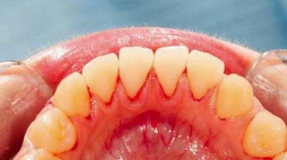 肾脏|肾衰竭的人，身体会发出4个“求救信号”，你若没有，偷偷高兴吧