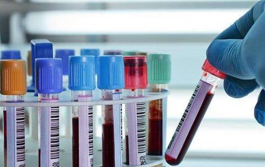 治疗|抗核抗体阳性、抗ro52抗体阳性是什么病?