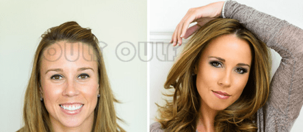 脸部专家科普:脸部做脂肪填充好吗?脸部脂肪填充安全吗?疑问解答~