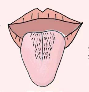 舌头图 乳状图片