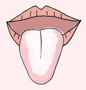伸出舌头看一看,这15个身体大小毛病通通现形!_舌苔