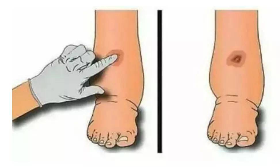 嗜茶|喝茶导致体重狂涨，医生找到了这个蛛丝马迹