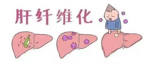 血管|肝纤维化不及时治疗，可致肝功能衰竭！