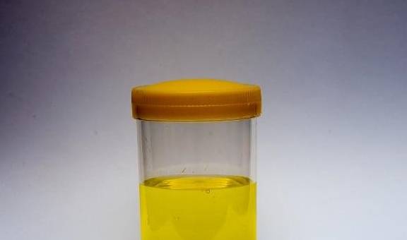 毒素|尿液发黄异味大?多半是在向你“报告”这4件事,希望你能放心上