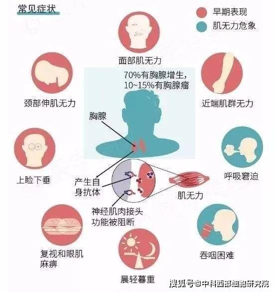 神经系统|中科西部干细胞研究院：干细胞的免疫调节能力拯救“重症肌无力”人群