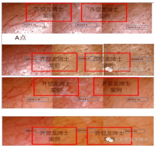 治疗齐显龙博士：敏感皮肤治疗和护理指南
