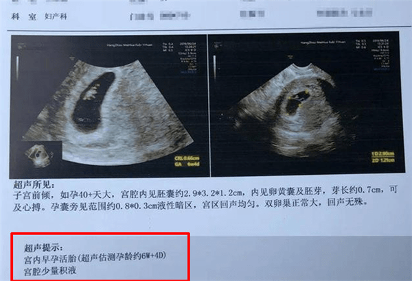 怀孕周期怎么算 28周算7个月么 胎儿