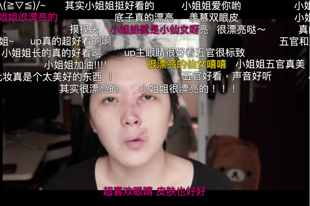 带着满脸疤痕的我，做了美妆博主