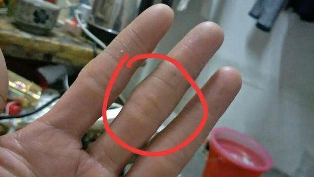 粗细|肝脏好不好，竖中指先知？若没有这3种异常，或许肝脏还算不错