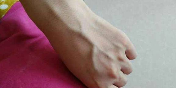 进行|手上若有这3个“标记”的人，恭喜，肝还算健康，不妨自测一下