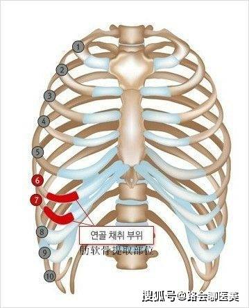 缺点那些整形医生可能不会告诉你的，鼻整形材料的缺点？