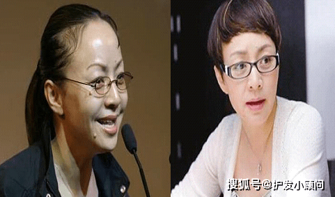 扒一扒做过植发的明星你认识几个