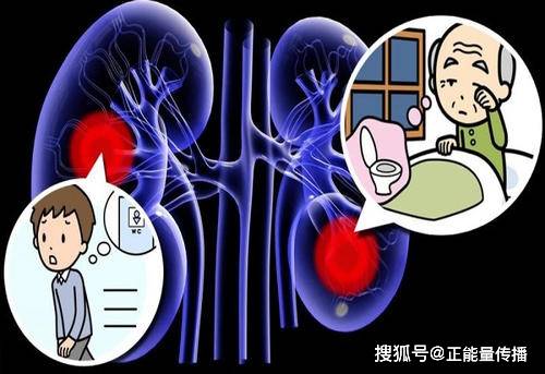 肾脏|肾功受损,身体知道!肾衰竭的6个早期症状,或是都被你忽视了