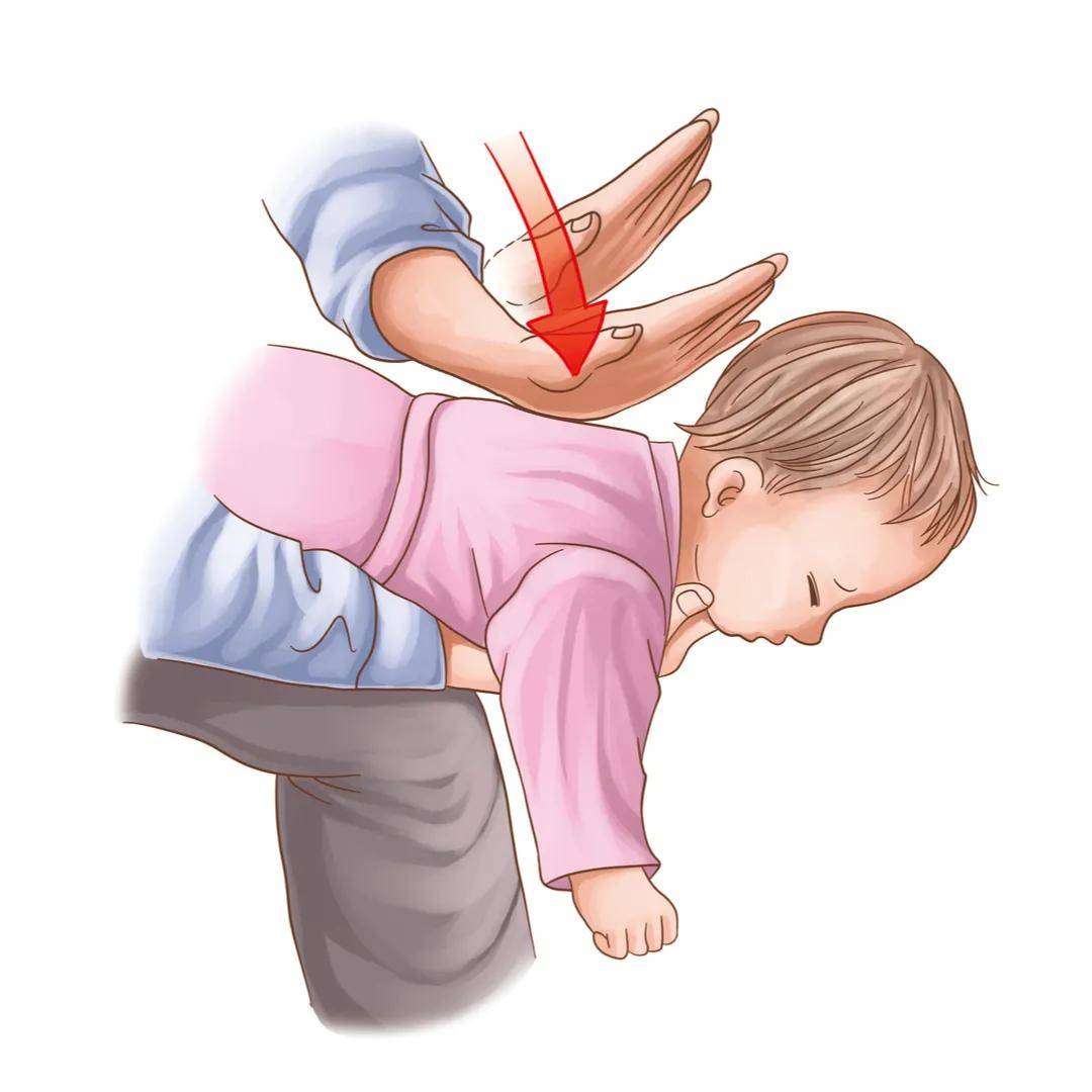 坚果|危险的「一分钟手术」差点要了2岁孩子的命，只因妈妈做这件小事