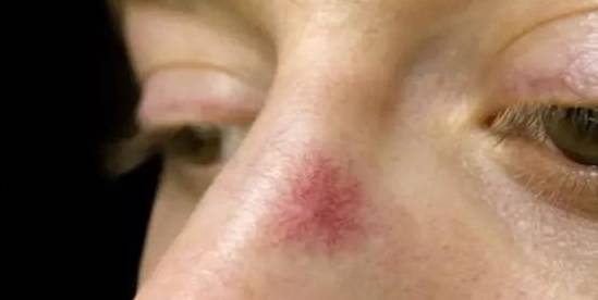 肝脏|肝功差的人，身体一般有5个表现，若没有，则肝脏还算健康