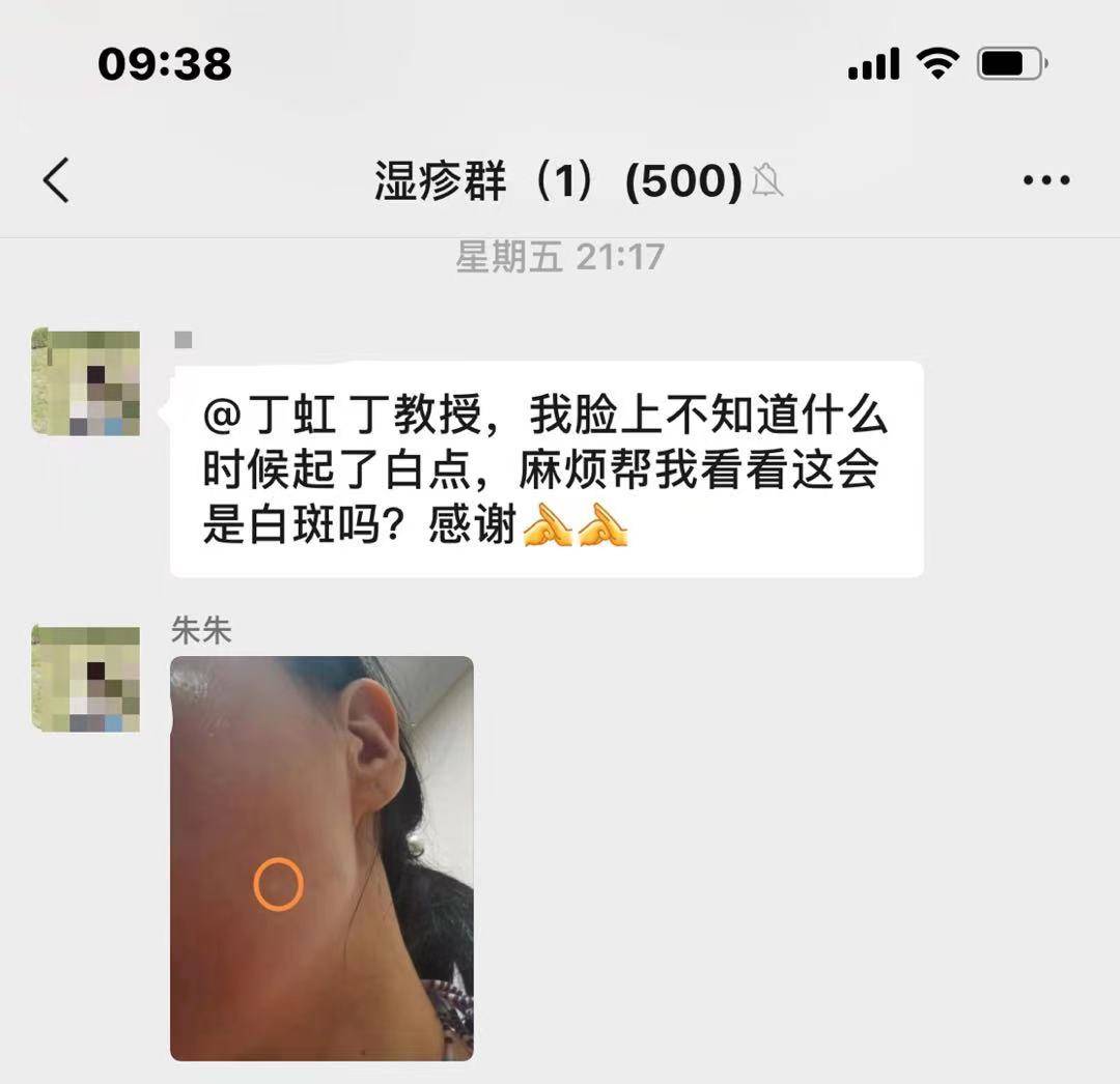 白点碧蒂曼诗3D仿生膏：脸上不知道为什么会起白点，应该怎么处理？