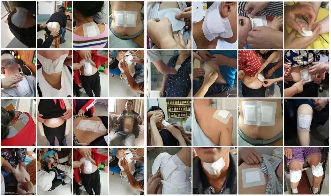 治疗|百草济世：不死的癌症——痛风，看中医如何治！