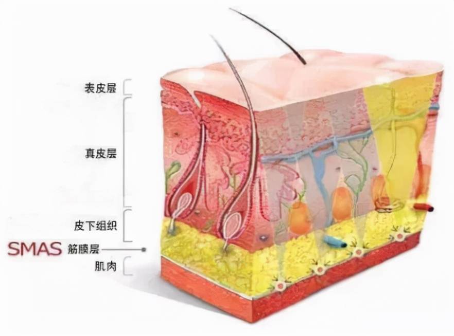 能量要你好看~6d线雕童颜术效果好吗？6d提升和线雕的区别大不大？