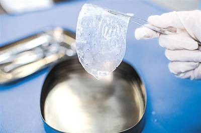 sis材料腹股沟疝生物补片. 博辉瑞进供图