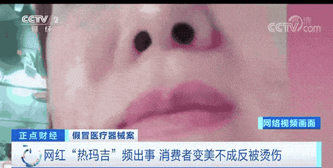 玛吉花3w做的热玛吉没给看二维码，很担心是假的，完全睡不着