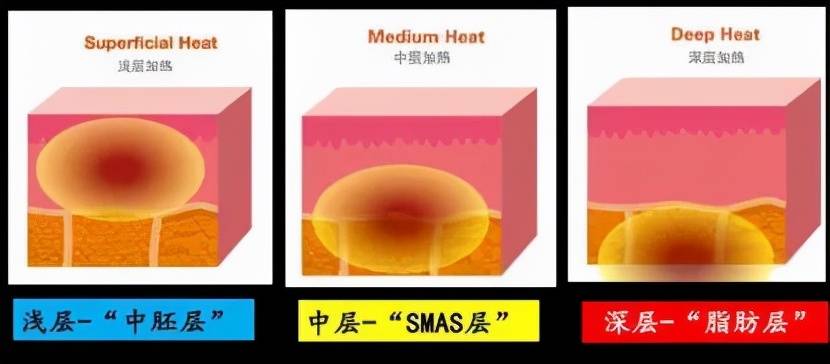 真皮大实话：热拉提多少钱做一次？热拉提多久做一次合适？