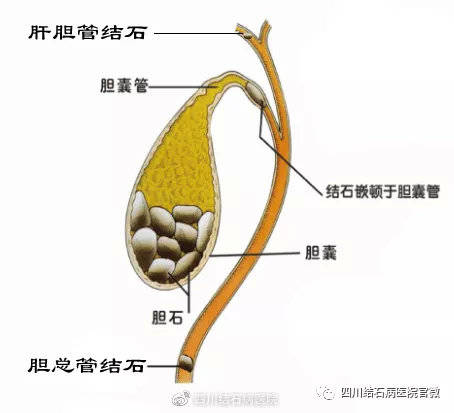 af27ebe8bf0147cb8d10e41fc41d9b77.jpeg