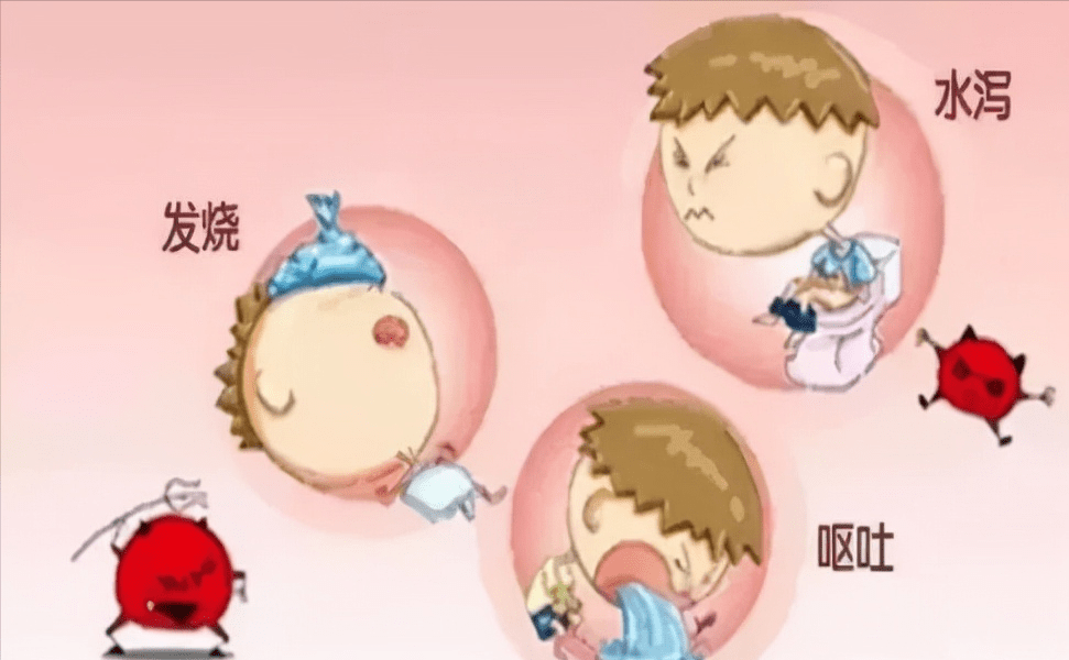 食物中毒的症状