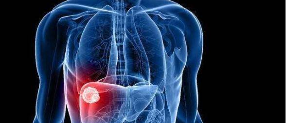 因为|肝脏最怕以下3件事，现在改过，还来得及