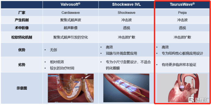 眼光|沛嘉医疗-B（9996.HK）：引领瓣膜领域创新方向，国际化布局极具前瞻眼光