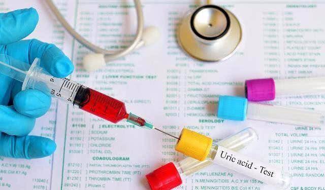 症状|尿酸高的人，若有这2种症状，可能已经连累到了肾脏，希望你没有