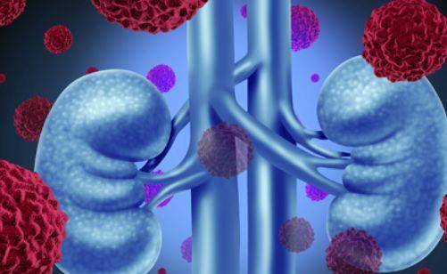 肾脏|“尿毒症”早期，身体可能会发生3个改变，希望你都没有