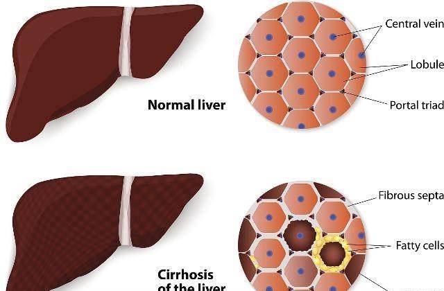 毒素|40岁后，这7个表现，若占3个以上，说明你肝脏还不错哦