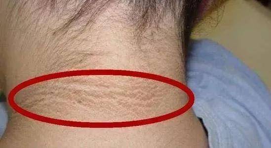 少运动|糖尿病，你不知道的遗传真相？！