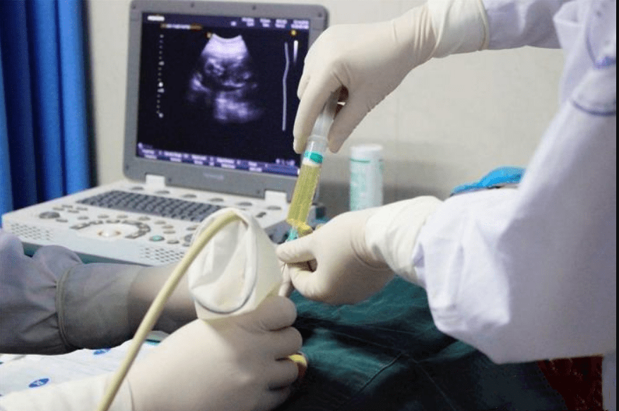 原创无创和羊穿是为了坑钱别被无知言论迷惑这项检查至关重要