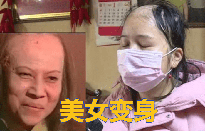 洗头美女洗头后秃成“裘千尺”，美发店猖狂回应：我又没给你用硫酸