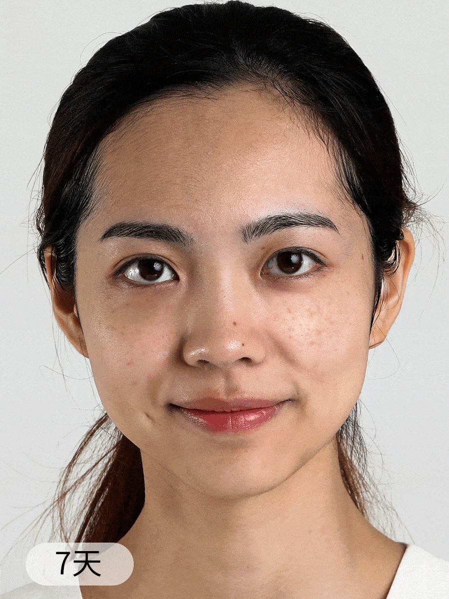 产品黄褐斑怎样才能彻底的去掉？这几款产品，很不错！