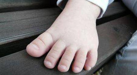 因为|不想患上糖尿病足，这3个细节你都要知道，很多人却不在乎