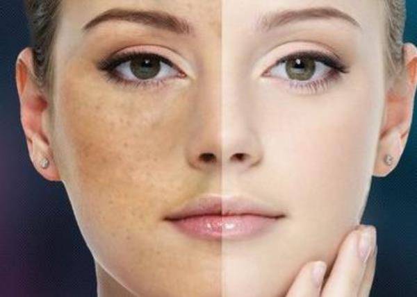 肝脏|常熬夜的人,可通过脸上的表现,判断肝脏是否受损