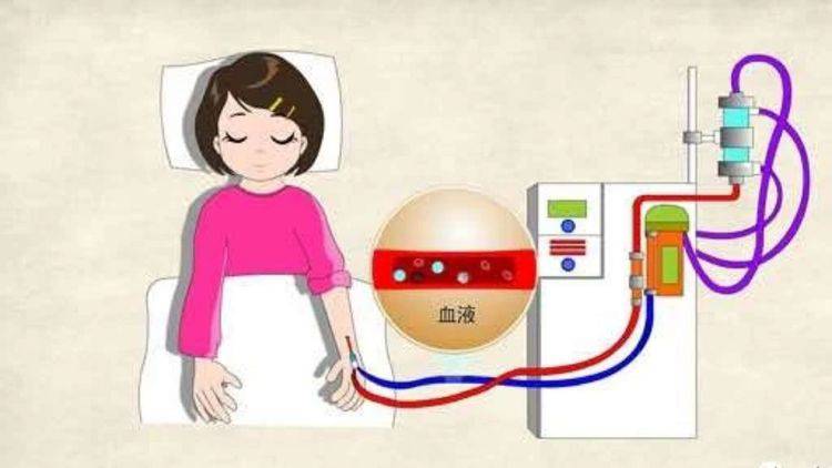 疗法|血液透析都会出现哪些并发症及处理方法