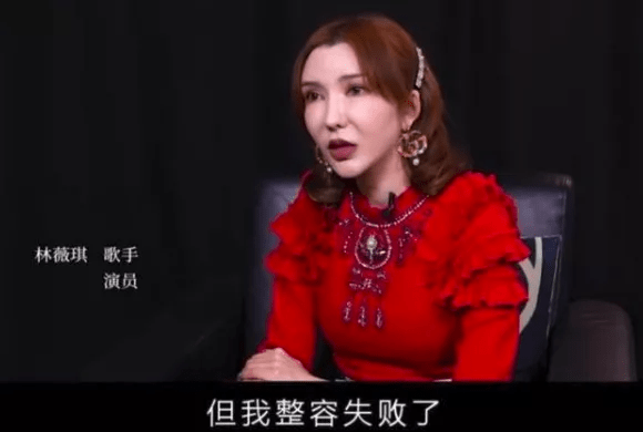 萧蔷变丑遭前男友嫌弃，为变美却断送前程，女星整容翻车实在太惨