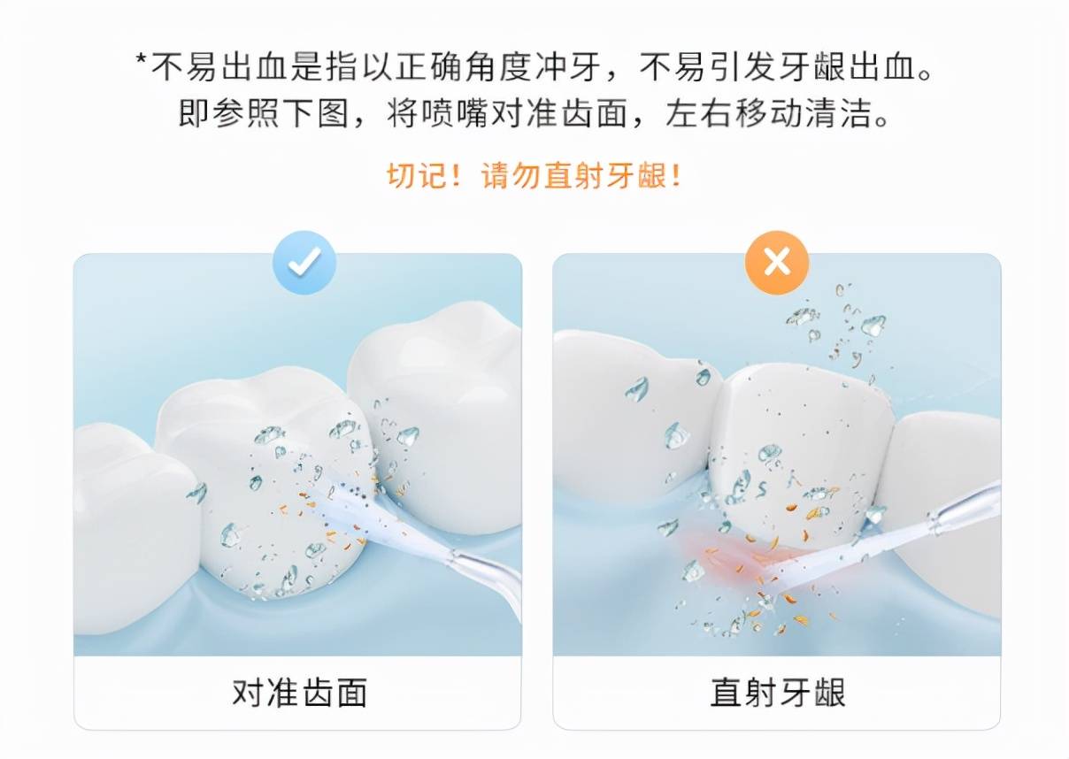 冲牙器的正确使用方法是垂直于齿面,沿着牙龈线缓慢移动,不要距离太远