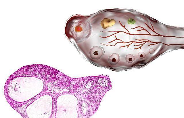 处于备孕阶段,女性该如何养护卵子?_排卵_身体_卵泡