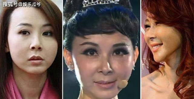 后遗症这些同龄女星都曾是绝世美人，有人整容后遗症像妖怪，有人美到老