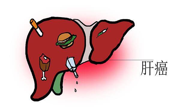治疗|从乙肝到肝癌,57岁男子的教训,值得我们反思,其实本可以避免