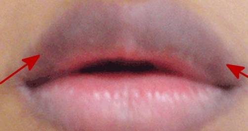 因为|肝病不痛不痒，若身体出现这3个症状，是肝在“呼救”，莫忽视！