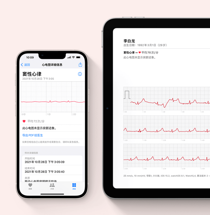 官宣|苹果正式官宣，Apple Watch国行版移动心电图房颤提示软件上线！