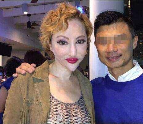 下巴明星的N种“假下巴”，尖到戳死人，翘成老巫婆，一个比一个怪异