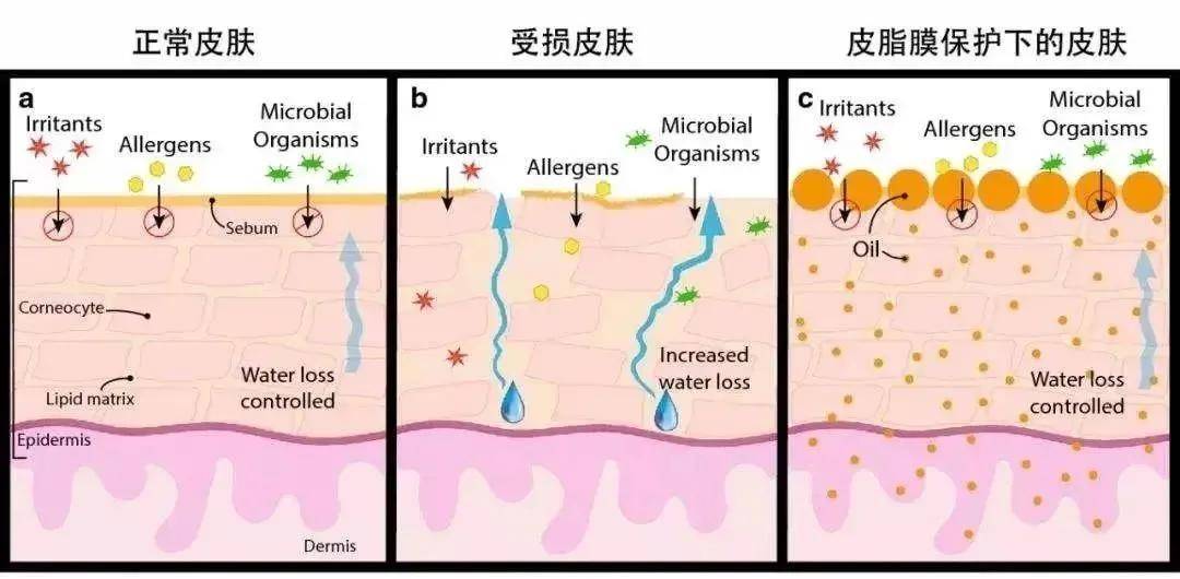 封闭性换季油敷法，干皮姐妹看过来！