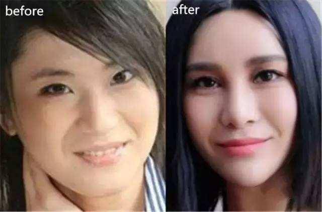 下巴明星的N种“假下巴”，尖到戳死人，翘成老巫婆，一个比一个怪异